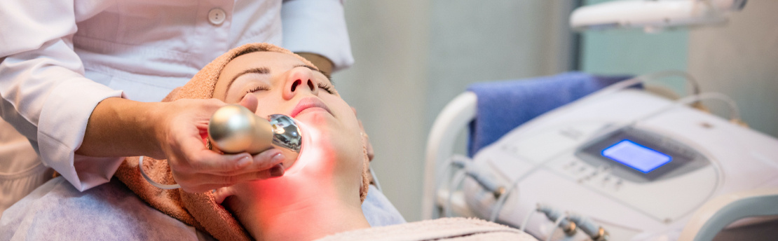 Laser Peel
